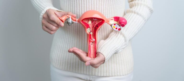 How to Treat Adenomyosis and Reclaim Your Life