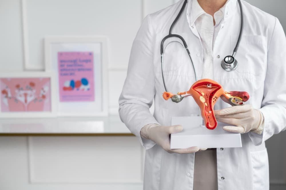adenomyosis specialist