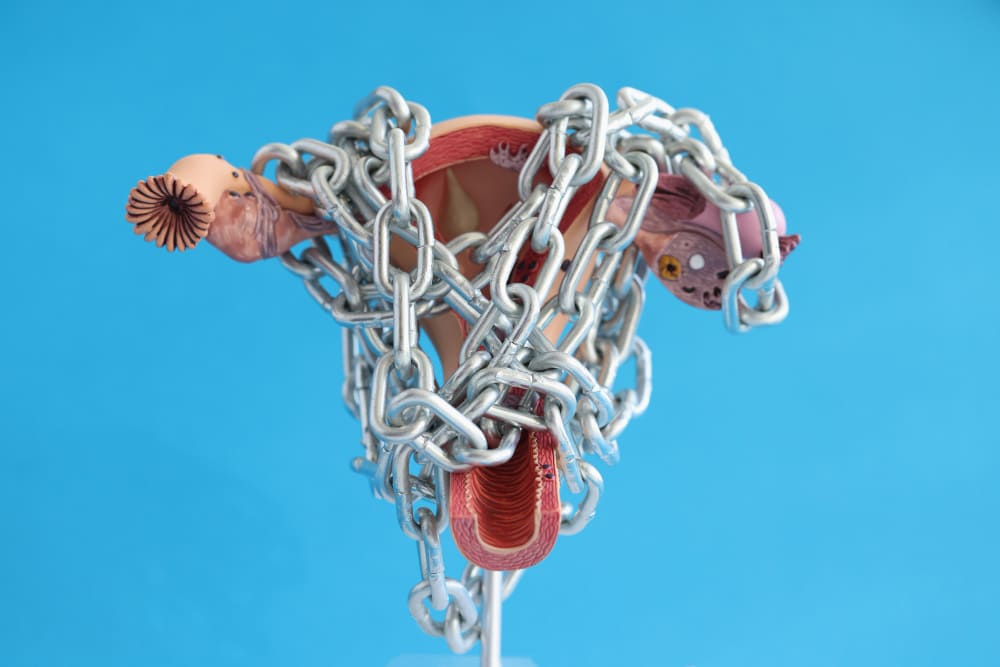 Hysterectomy Side Effects: What Women Need to Know Before Surgery