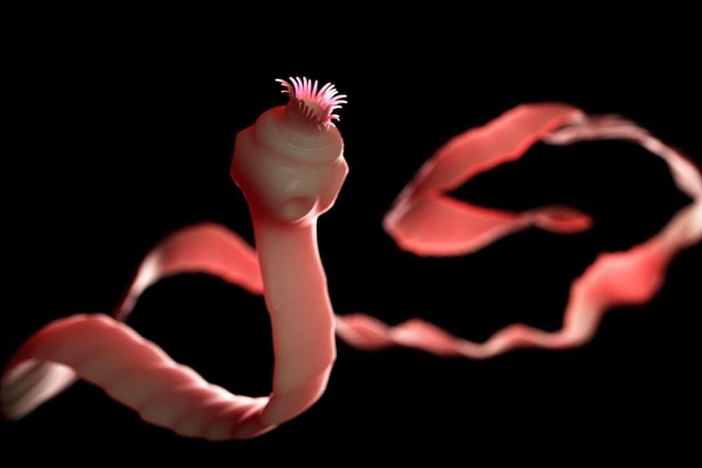 Adenomyosis Stage 4 Symptoms