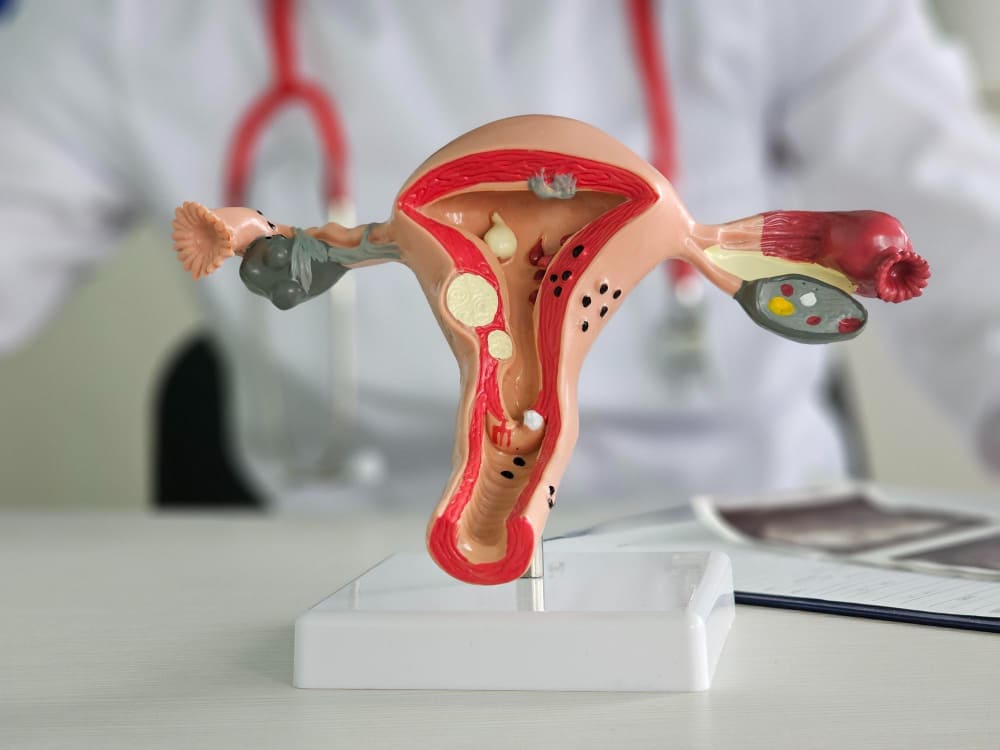 الرحم الغدي _ أسباب التغدد الرحمي