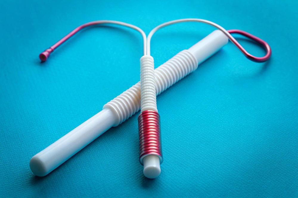 اعرفي العلاقة بين اللولب الهرموني والتغدد الرحمي