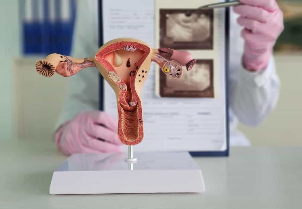 متى يقرر الطبيب استئصال الرحم