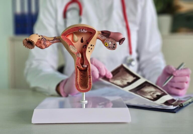 Adenomyosis Symptoms: How to Recognize and Manage the Condition?