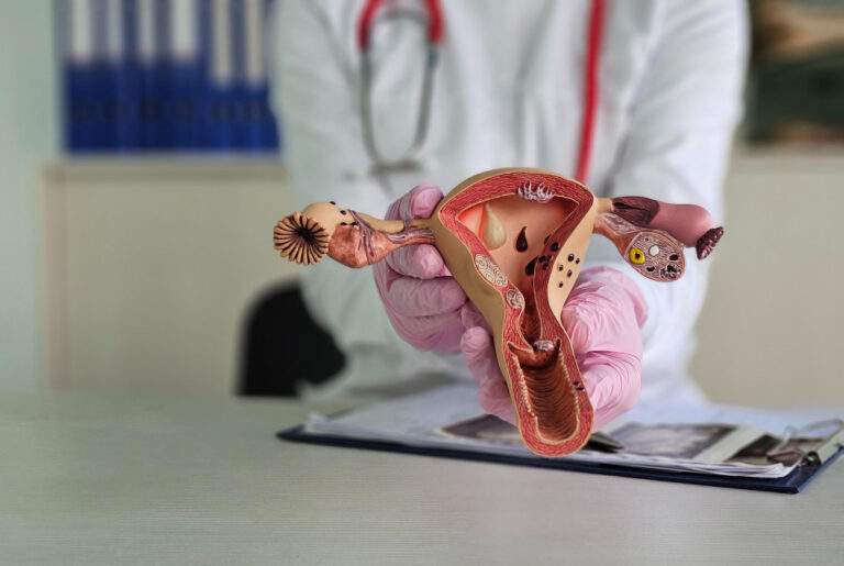 هل التغدد الرحمي هو الورم الليفي