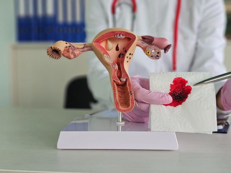 الأعراض الجانبية بعد استئصال الرحم: هل هناك بديل أفضل؟