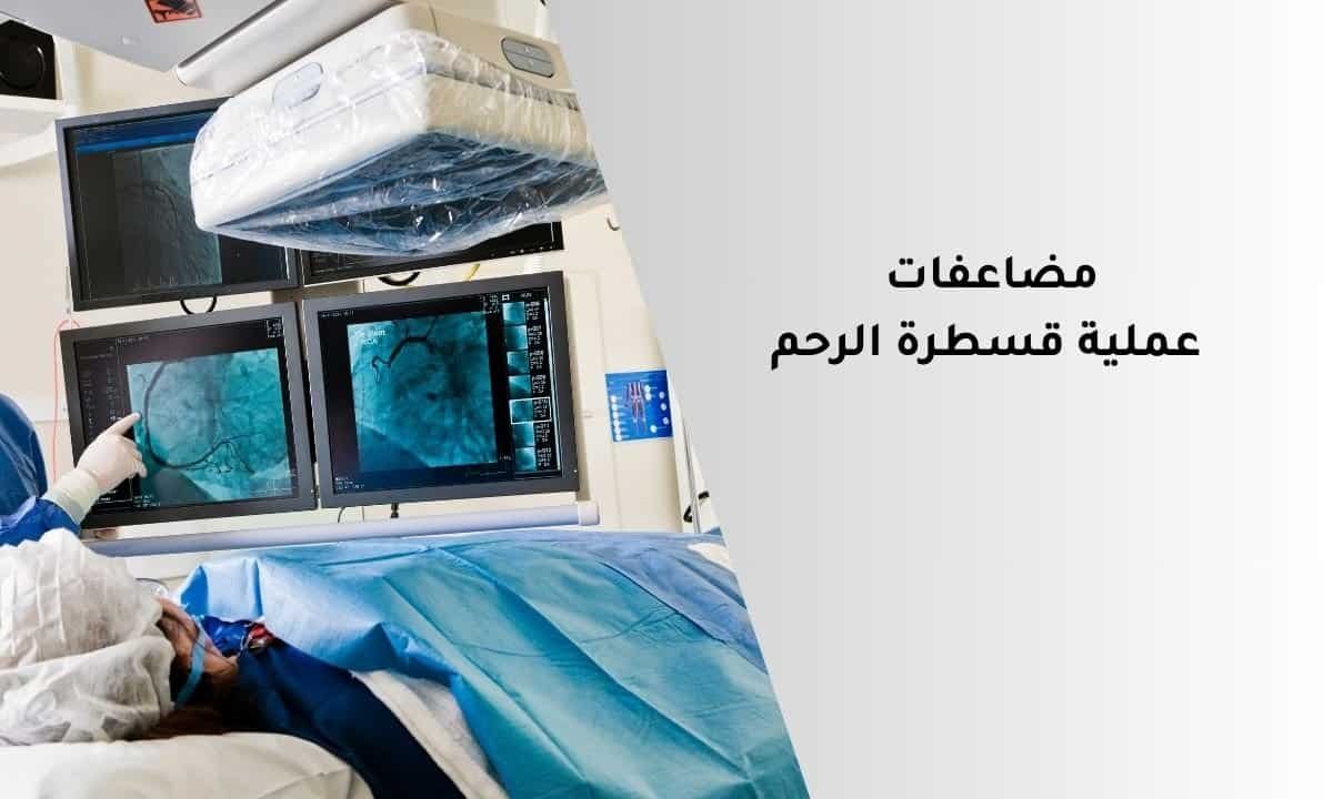 مضاعفات عملية قسطرة الرحم