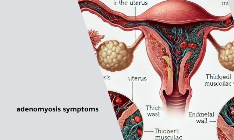 Adenomyosis Symptoms How To Recognize And Manage The Condition