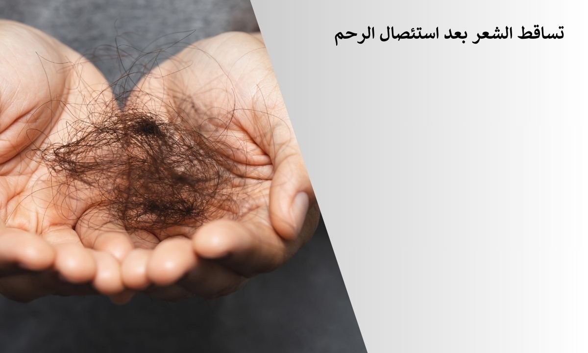 تساقط الشعر بعد استئصال الرحم