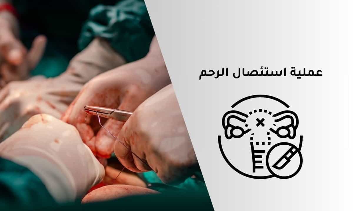 عملية استئصال الرحم