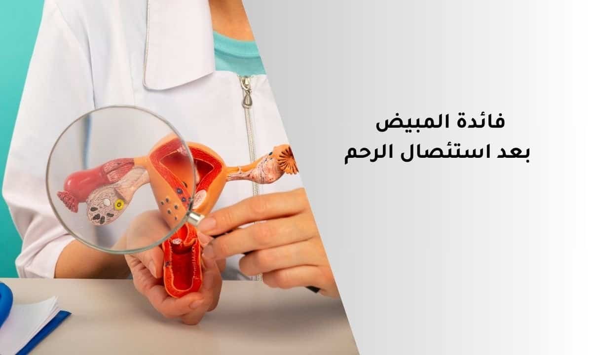 فائدة المبيض بعد استئصال الرحم