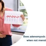 Does Adenomyosis Cause Pain When Not Menstruating