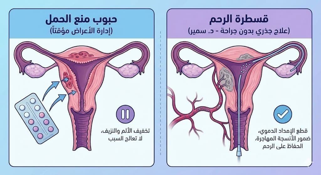 هل حبوب منع الحمل لعلاج التغدد الرحمي